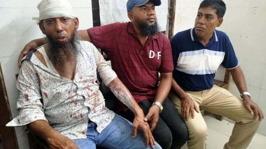 বরিশালে যুবদল নেতাকে কুপিয়ে গরম পানি ঢেলে দিয়েছে সাবেক ছাত্রদল নেতা