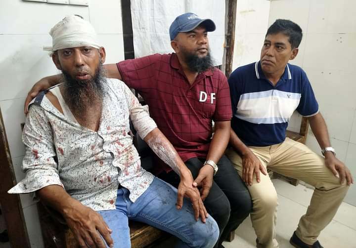 বরিশালে যুবদল নেতাকে কুপিয়ে গরম পানি ঢেলে দিয়েছে সাবেক ছাত্রদল নেতা