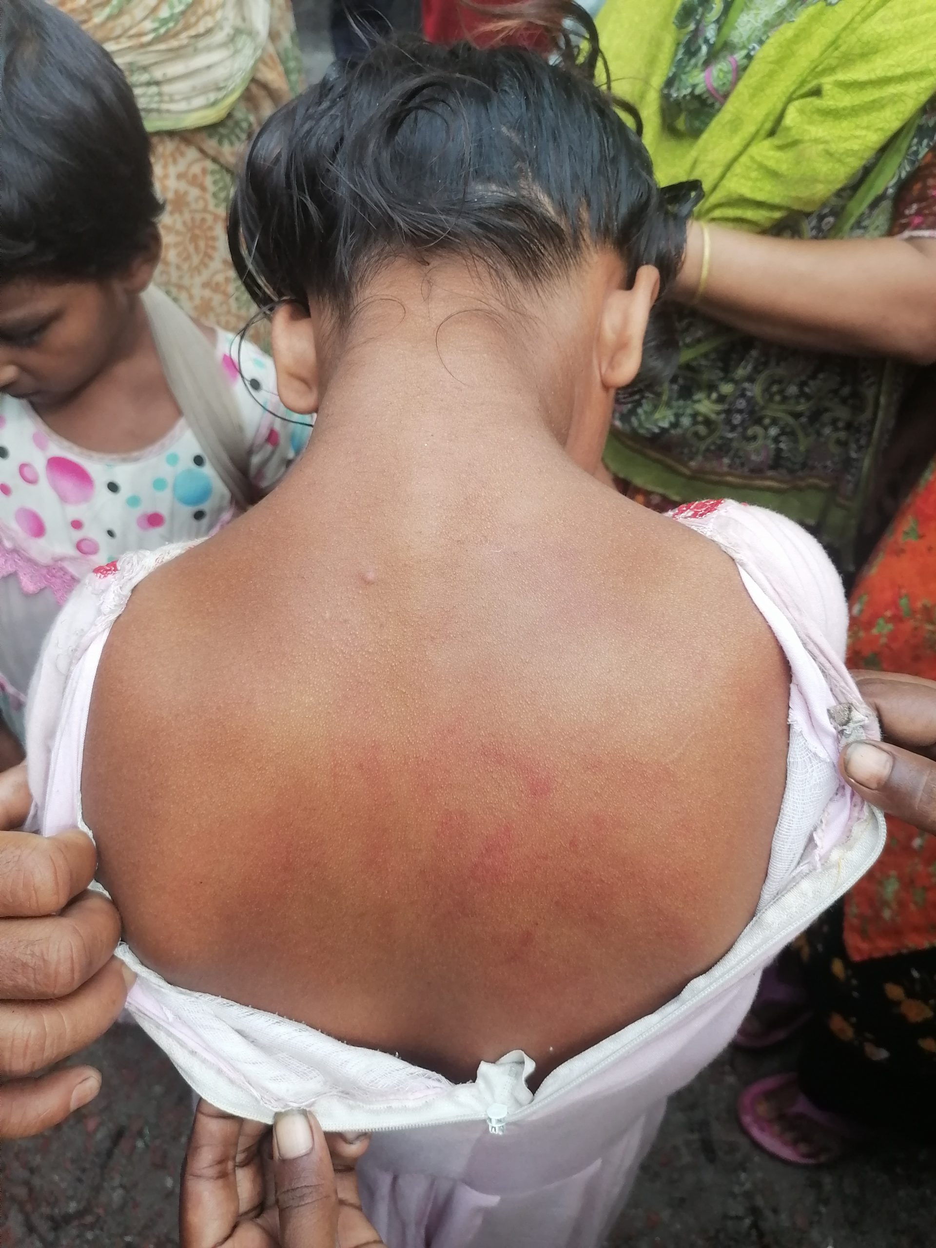 নগরীতে বুদ্ধি প্রতিবন্ধী পঞ্চম শ্রেণীর ছাত্রীকে মারধর!