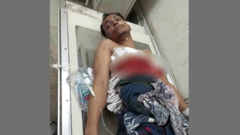 গালিগালাজের প্রতিবাদ, কোমর থেকে পিস্তল বের করে গুলি
