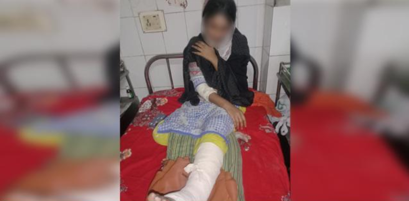 বরিশালে ভাইয়ের কবর ভাঙতে বাধা দেয়ায় বোনের পা ভেঙে দিলো প্রতিপক্ষ
