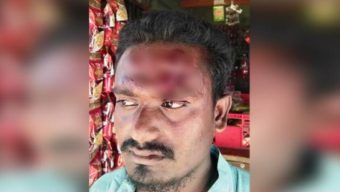 পলাশপুরে তুচ্ছ ঘটনায় ঠিকাদারকে কুপিয়ে টাকা ছিনতাই
