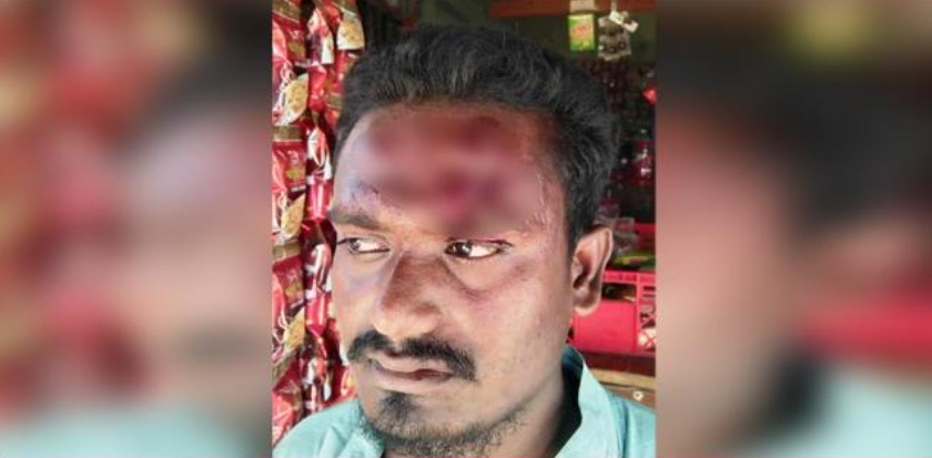 পলাশপুরে তুচ্ছ ঘটনায় ঠিকাদারকে কুপিয়ে টাকা ছিনতাই