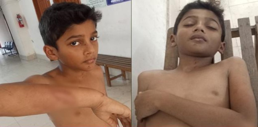 উজিরপুরেবলৎকারের কথা বলে দেয়ায় মাদ্রাসাছাত্রকে বেধম পেটালেন শিক্ষক!
