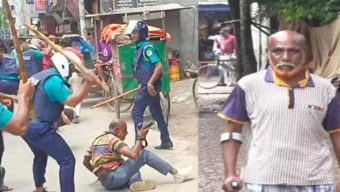 জুলাই আন্দোলনে পুলিশের লাঠিচার্জের পর এখনো সোজা হয়ে দাঁড়াতে পারেননি সাংবাদিক শামীম