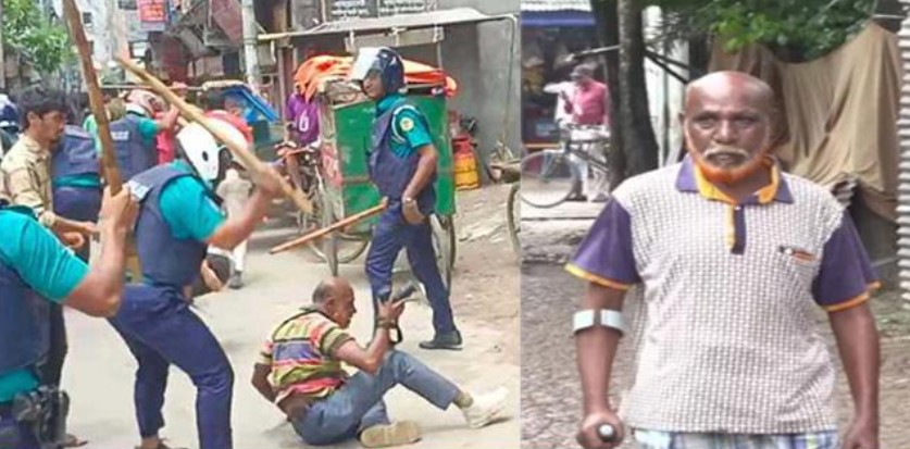 জুলাই আন্দোলনে পুলিশের লাঠিচার্জের পর এখনো সোজা হয়ে দাঁড়াতে পারেননি সাংবাদিক শামীম