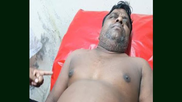 উজিরপুরে মাদকের প্রতিবাদ করায় ব্যবসায়ীকে হত্যার উদ্দেশ্যে ছুরিকাঘাত