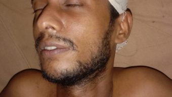 বরিশালে পূর্ব শত্রুতার জেরে এক যুবককে হাতুড়ি দিয়ে পেটানোর অভিযোগ