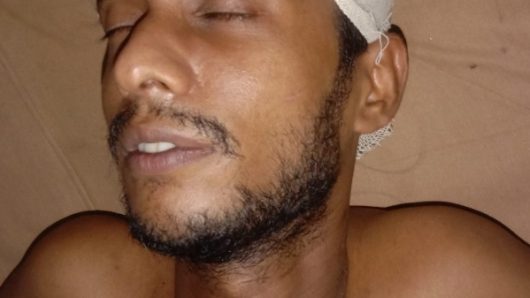বরিশালে পূর্ব শত্রুতার জেরে এক যুবককে হাতুড়ি দিয়ে পেটানোর অভিযোগ