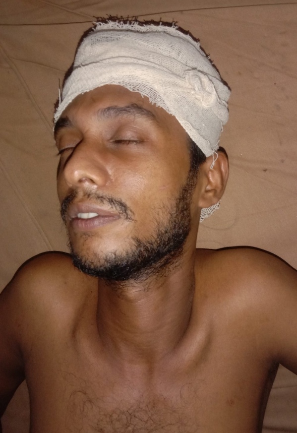 বরিশালে পূর্ব শত্রুতার জেরে এক যুবককে হাতুড়ি দিয়ে পেটানোর অভিযোগ